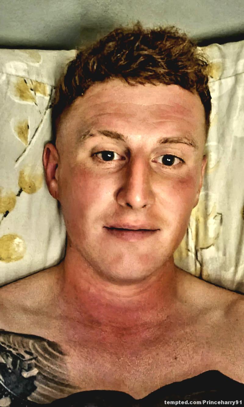 Prince Harry 