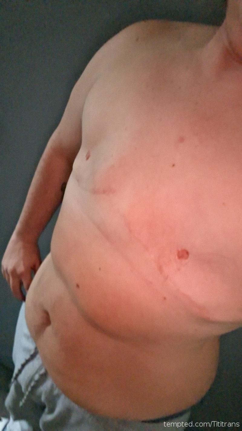 Trans