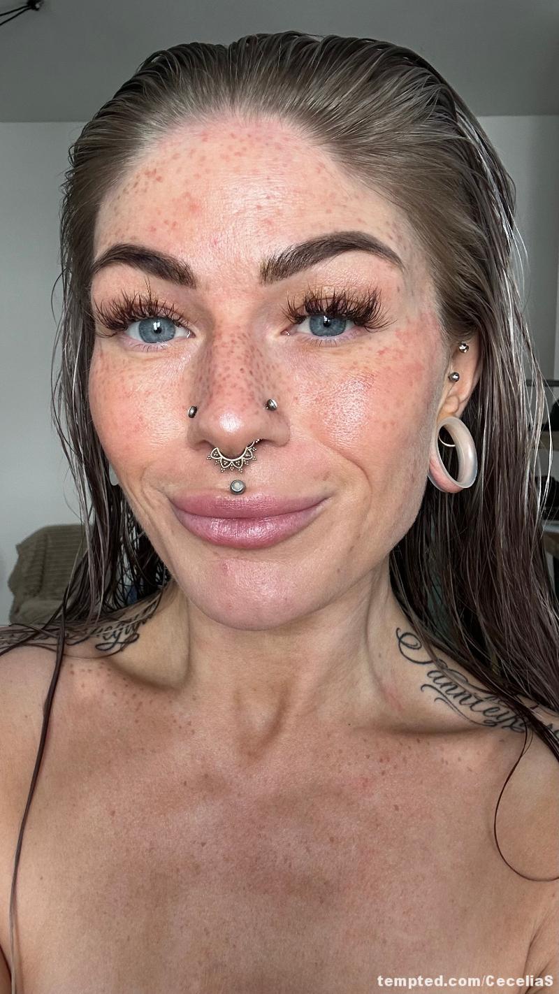 Freckles