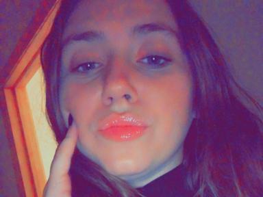 Dimples28