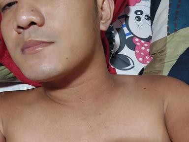 Lobe