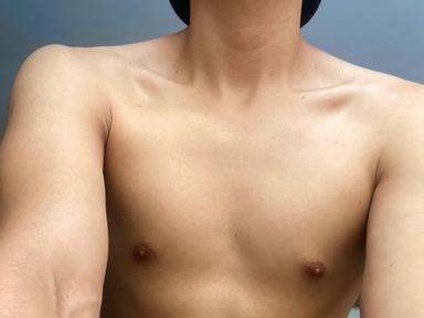 albert_xxx