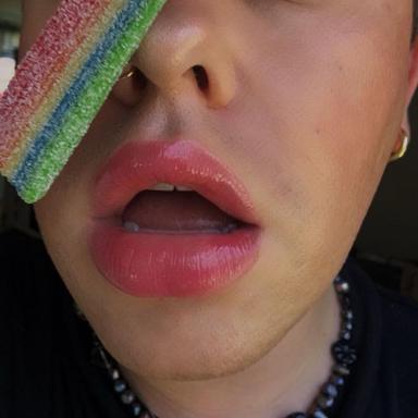 SweetTreats