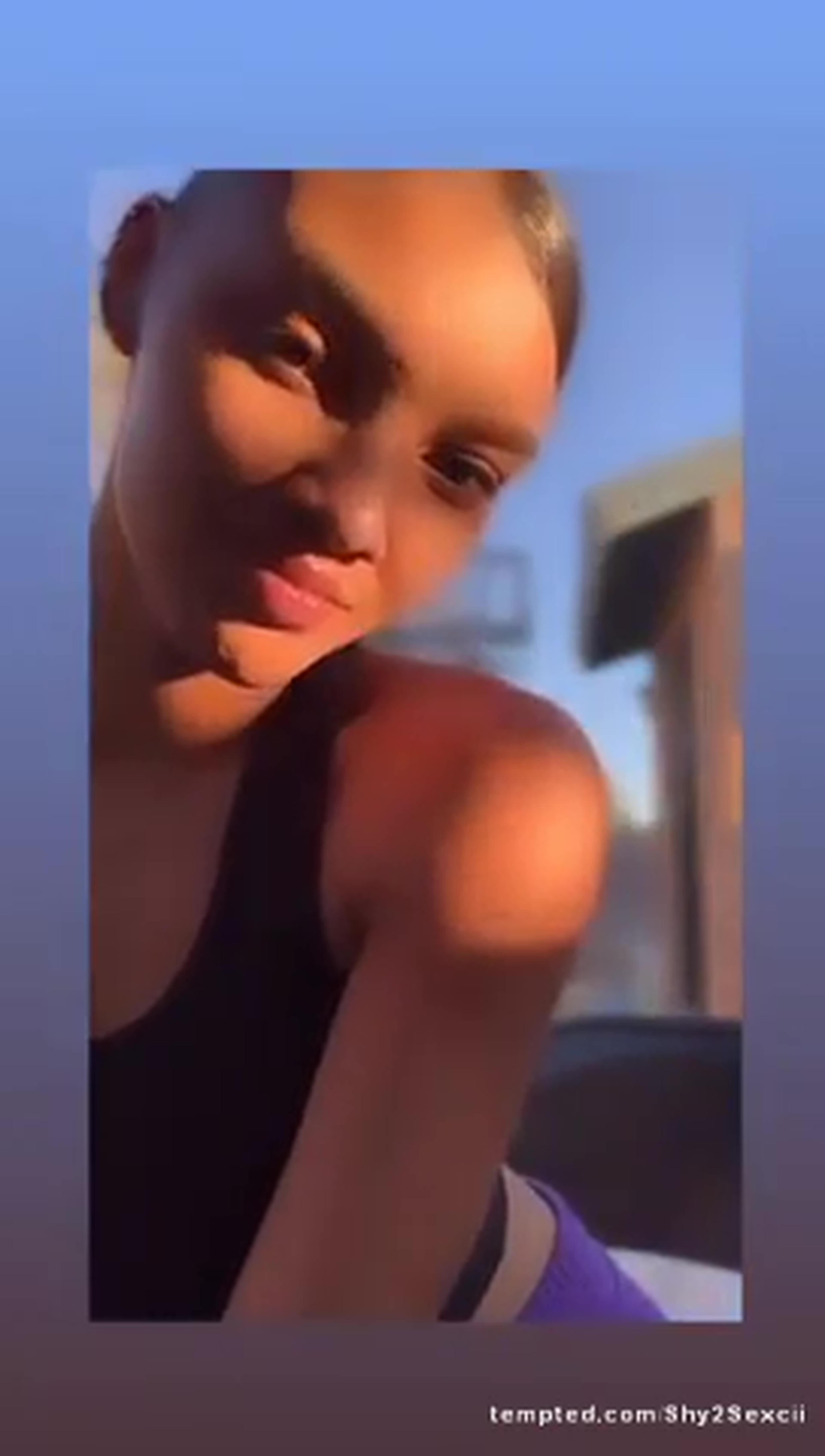 Sun kissed 💋