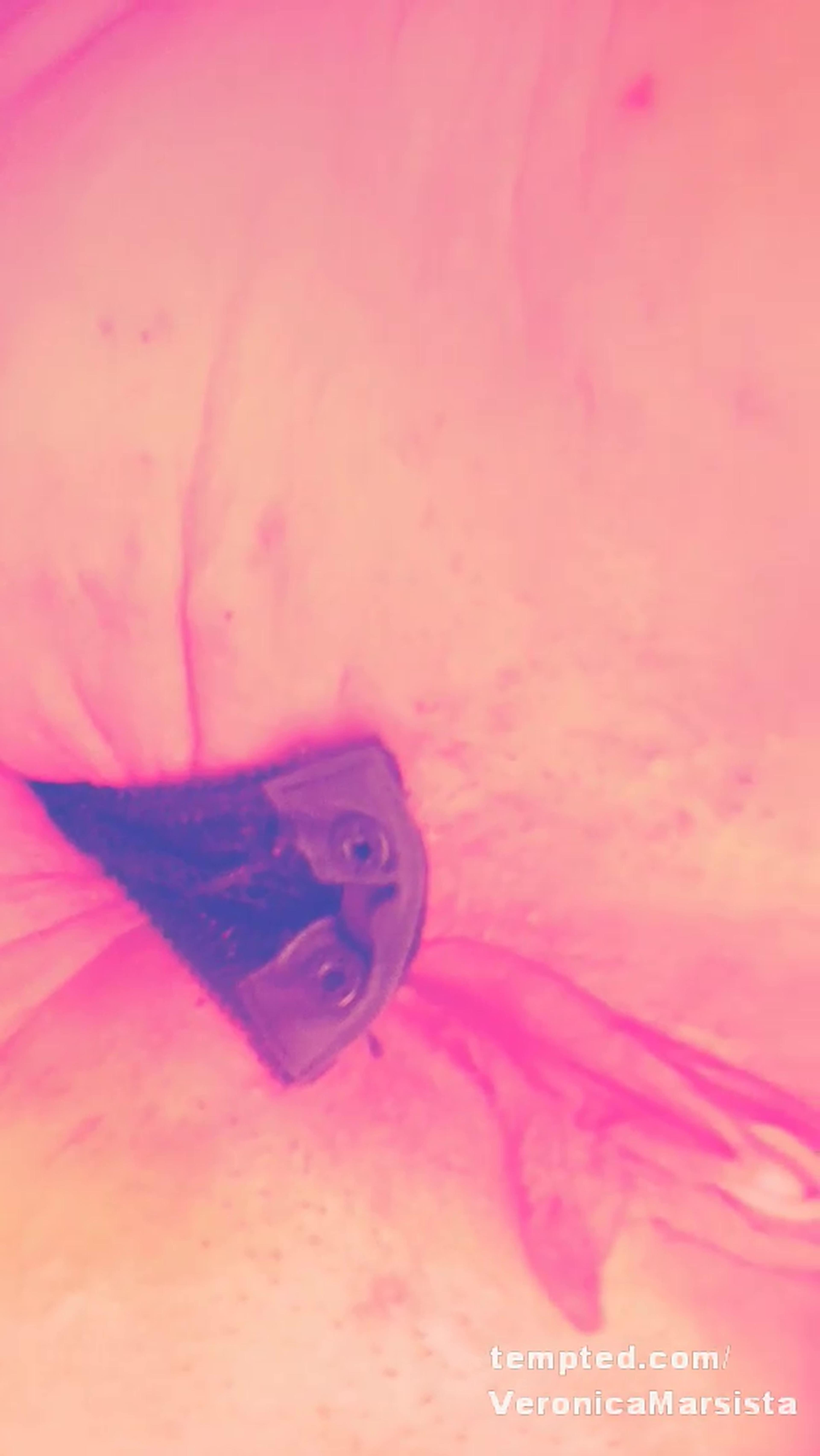 Teaser